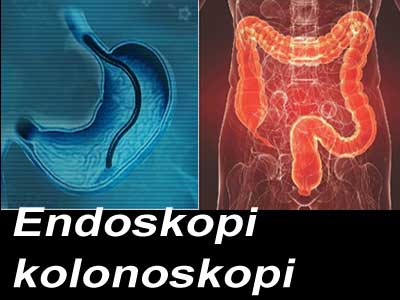 endoskopi-kolonoskopi-ultrason-orucu-bozar-mi