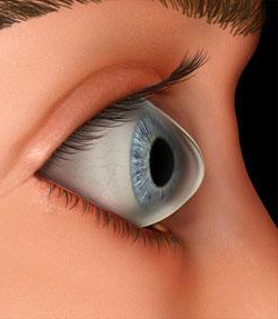 Göz Hastalıklarının Sebepleri Nelerdir ?