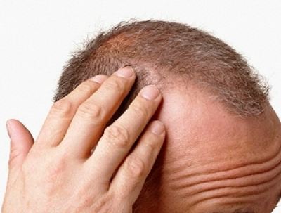 Saç, Kıl ve Tırnak Hastalıklarının Sebepleri Nelerdir ?